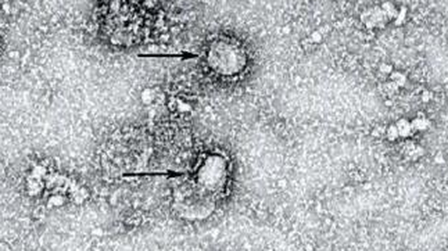 Peneliti: Virus Corona Bisa Bunuh 65 Juta Jiwa dalam 18 Bulan